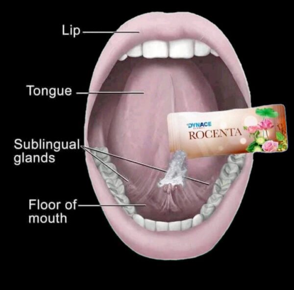 Dynace Rocenta - Image 4